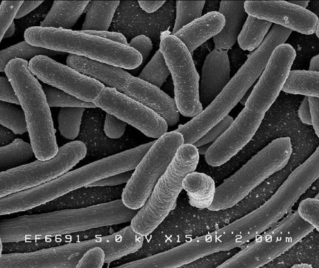 Credit: Rocky Mountain Laboratories, NIAID, NIH